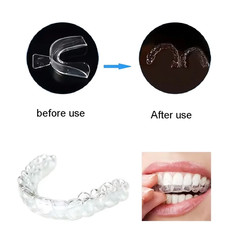 10/20Pcs Silicone Night Mouth Guard Tooth Care Removable Gingiva Guard Thermoforming Mouth Trays Whitening Tray