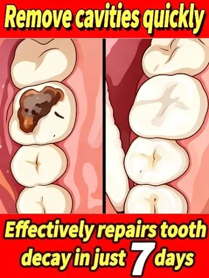 Gum Repair Toothpaste Plaque Caries Removal Protect Gingiva Treat Bad Breath Fade Tooth Stain Deep Clean Brightening Toothpaste