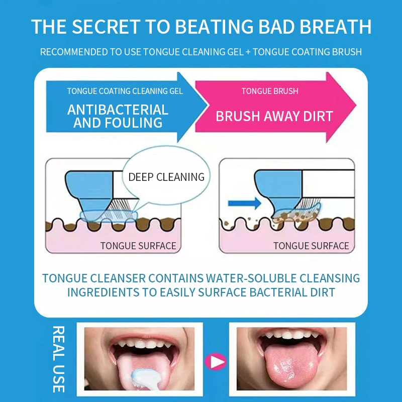 Tongue Scraper and Coating Cleaning Gel  Fresh Remove Oral Odor To Cleaner for Bad Breath Clean