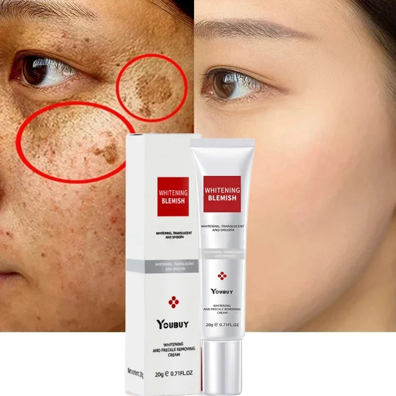 

Whitening Freckle Cream Melasma Cream Pekas Remover Dark Spots Remover Brighten Skin Anti-Aging Skin Whitening Cream