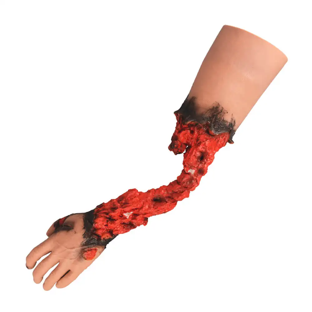 Ultrassist Partial Arm Amputation Wound Simulator Left Wearable Realistic Trauma Training for Medical Emergency Trauma Practice