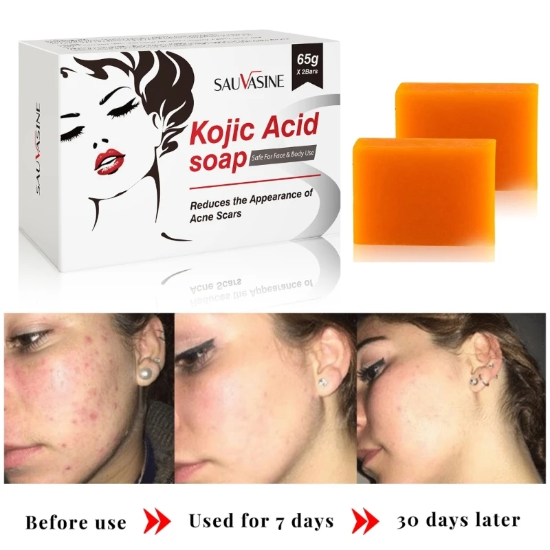 

2Pcs Kojie Acid Handmade Whitening Soap Skin Lightening Soap Bleaching Kojic Acid Glycerin Soap Cleaning Brighten Dropship