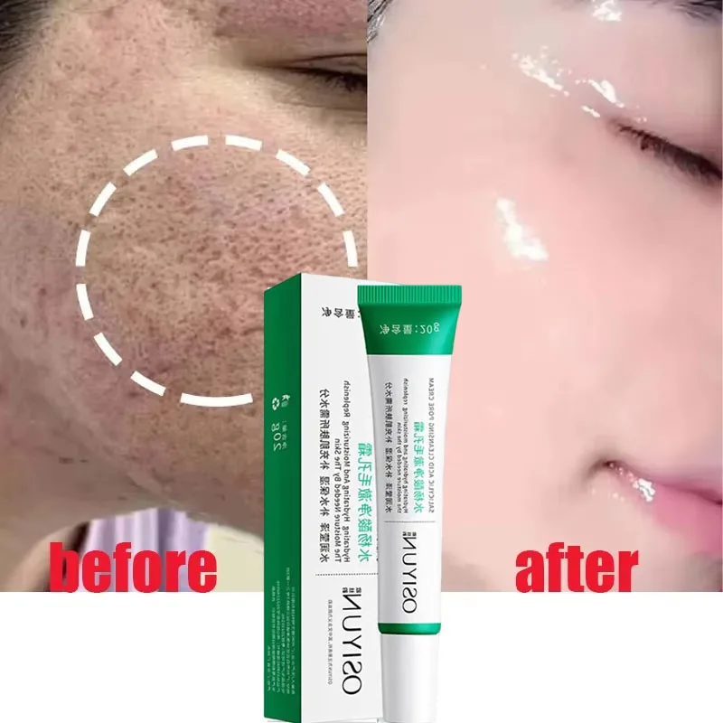 Salicylic Acid Pore Shrinking Cream Fast Elimination Large Pores Remove Blackehead Tighten Face Smooth Repair Skin Beauty Care