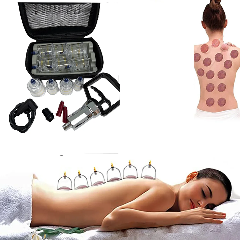 10 cupping cups in five sizes, plastic cupping, massage therapist-specific massage cupping set, Chinese cupping set