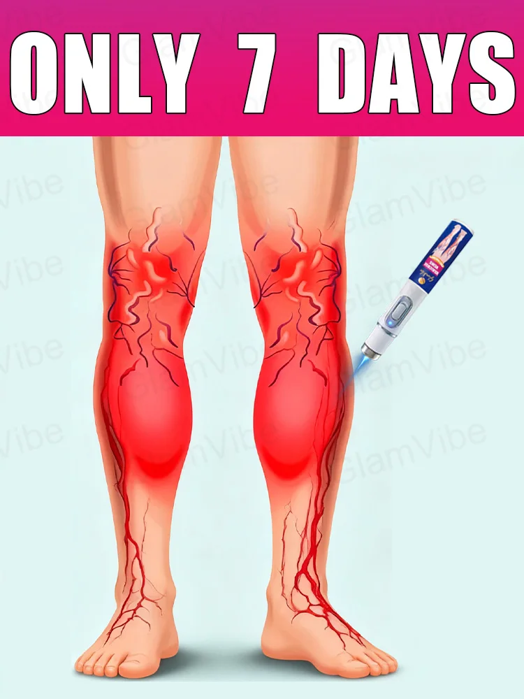 

blue light pen solve varicose veins, hot sale leg care tools