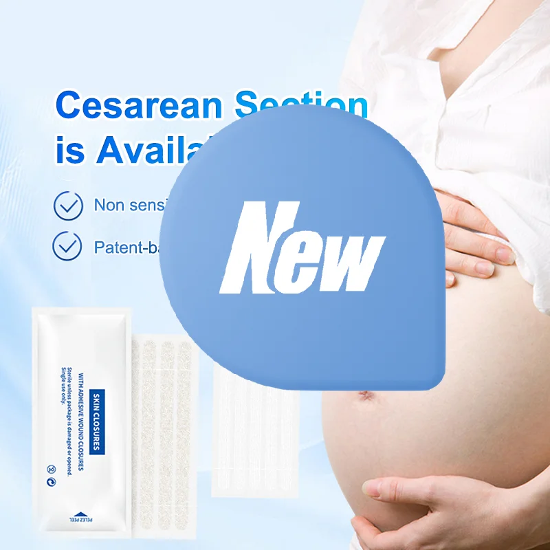 1 حقيبة شرائط إغلاق الجلد الجرح بعد الولادة إصلاح الجروح جراحة التجميل قطاع لاصق خياطة طبية شريط جراحي مجاني