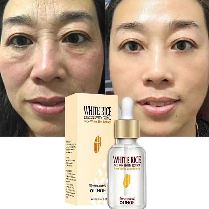 Rice Facial Serum Anti Aging Face Lift Dark Spots Remover Whitening Facial Moisturizer Korean Skin Care  Cosmetics Makeup 30ML