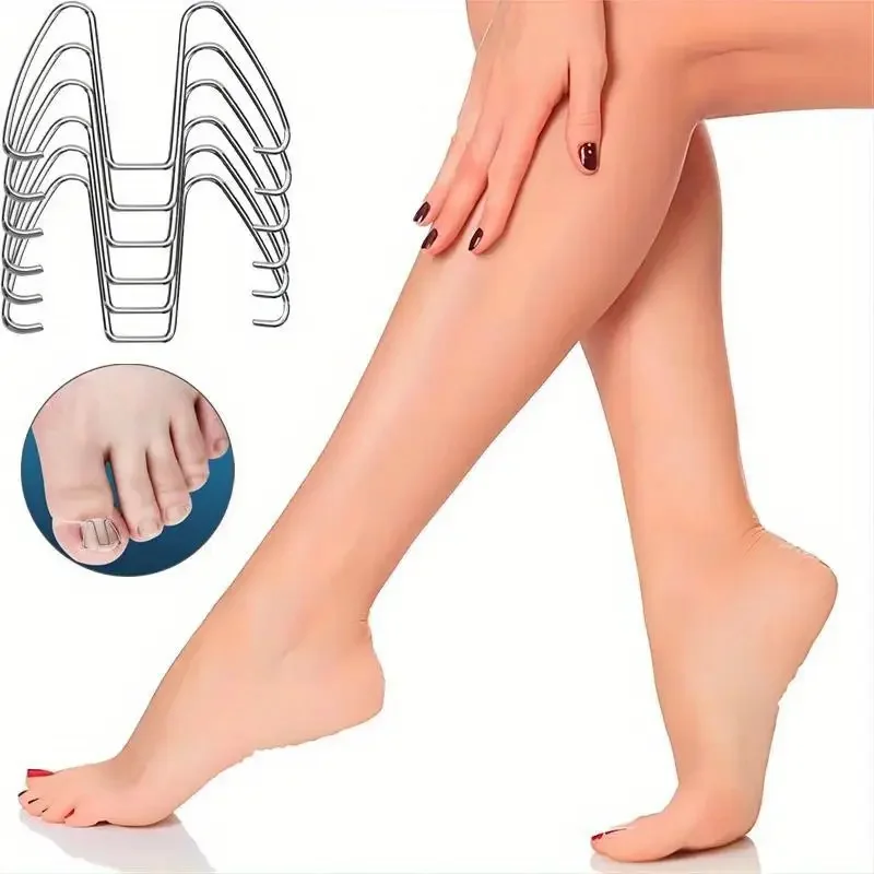 ชุดเครื่องมือแก้ไขเล็บข้อเท้าเกิดจากเล็บงอกขึ้น 6 ชิ้น พร้อมที่รัดเล็บ/ยางรัดสำหรับยืดเล็บ รักษาโรคเล็บข้อเท้าอักเสบ และทำเล็บเท้า