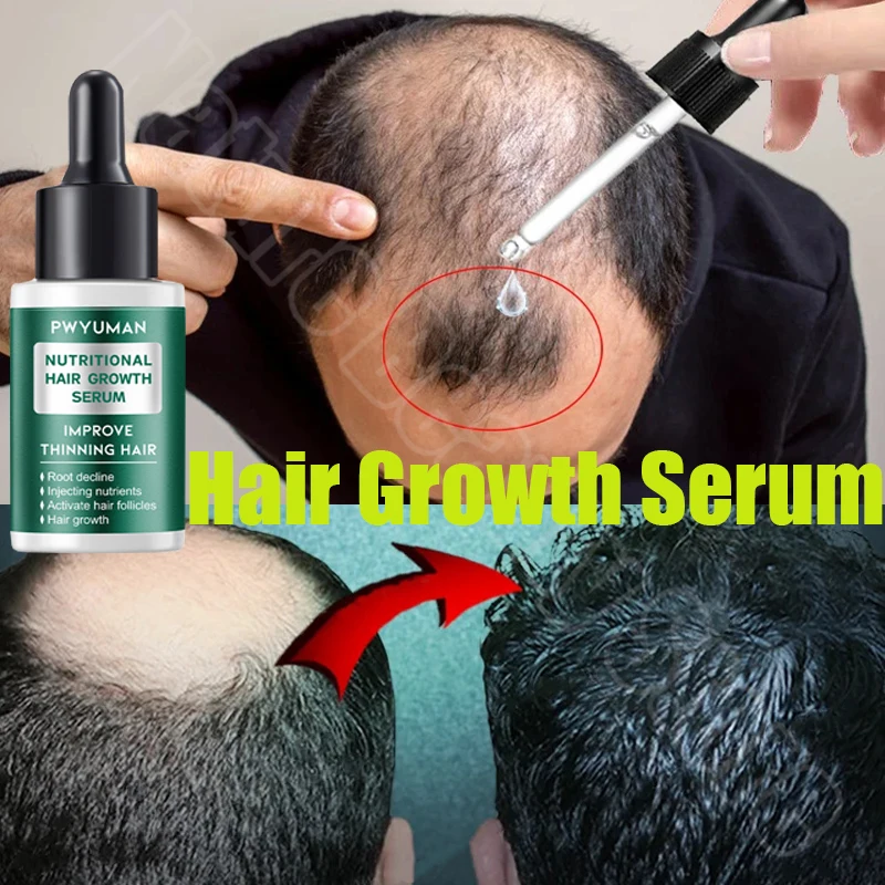 Produtos para o crescimento do cabelo do gengibre para homens e mulheres Tratamento da perda de cabelo Rebrota rápida Reparação de engrossar Líquida Nutritiva de Biotina