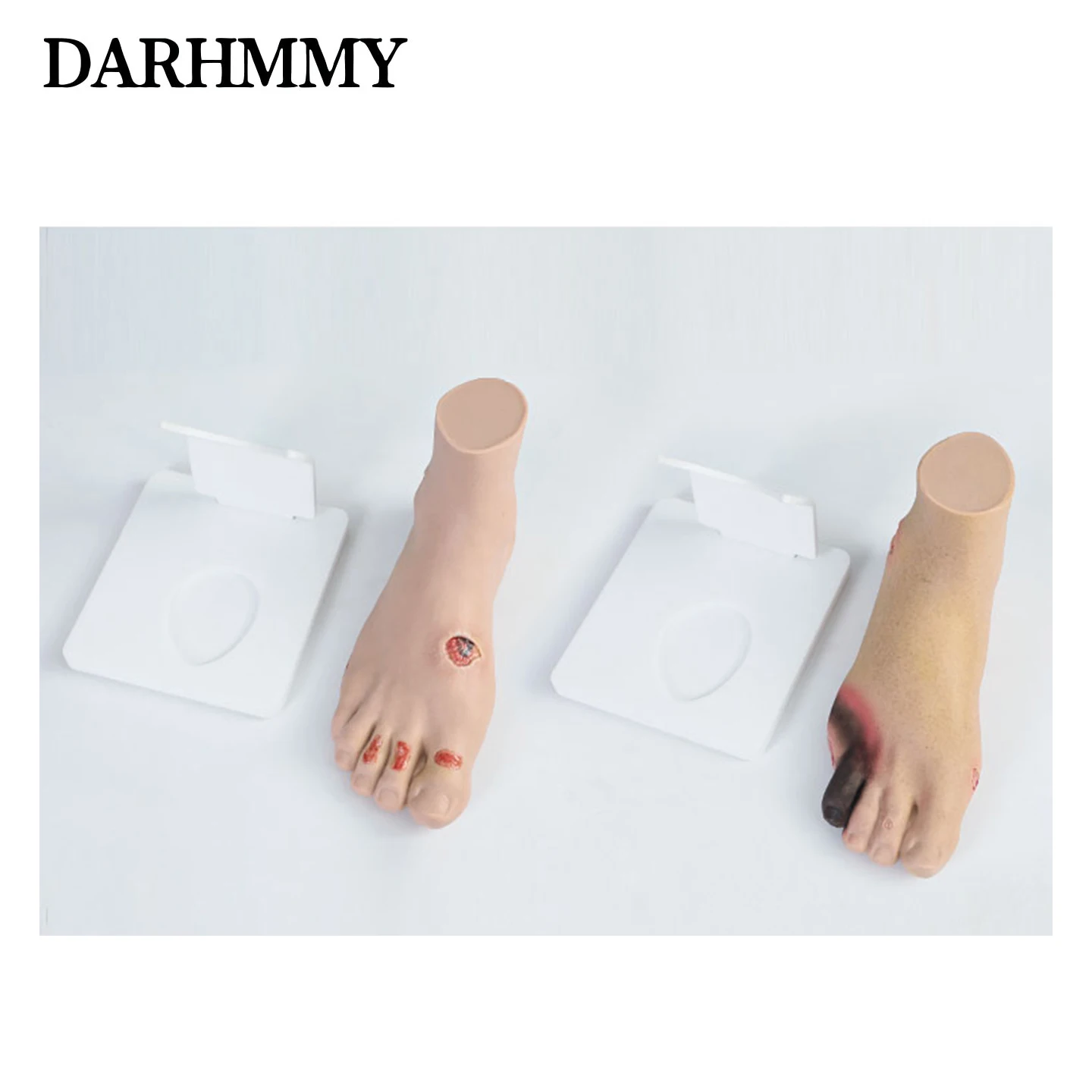 Diabetic Foot Care Model: Foot and Leg Ulcers in Diabetic Patients; Medical Conditions: Ulcerated Feet and Legs