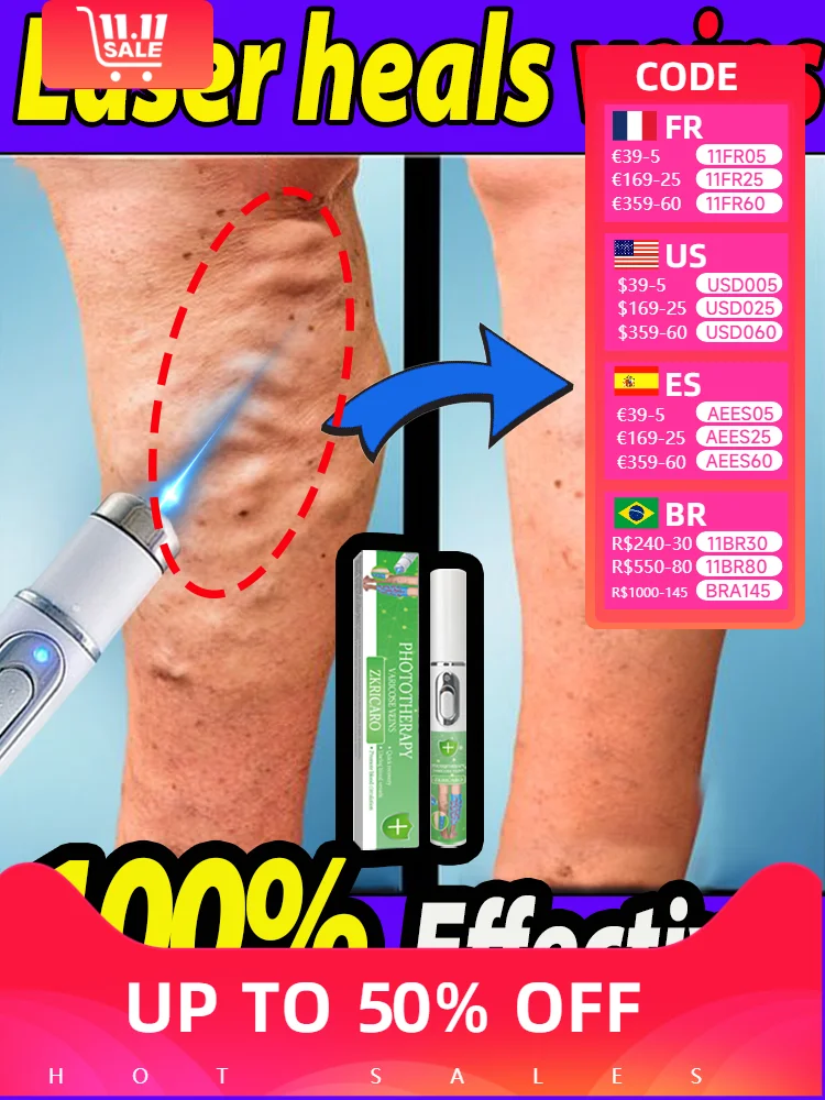 

Blue Laser Heals Veins, Solve Leg Problems