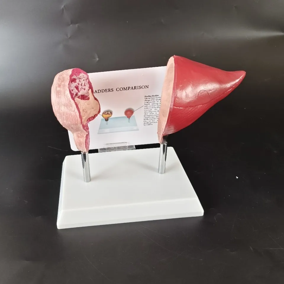 Comparison of normal visceral organs with heart and lung bladder vessels, oral tracheal fetal medical model