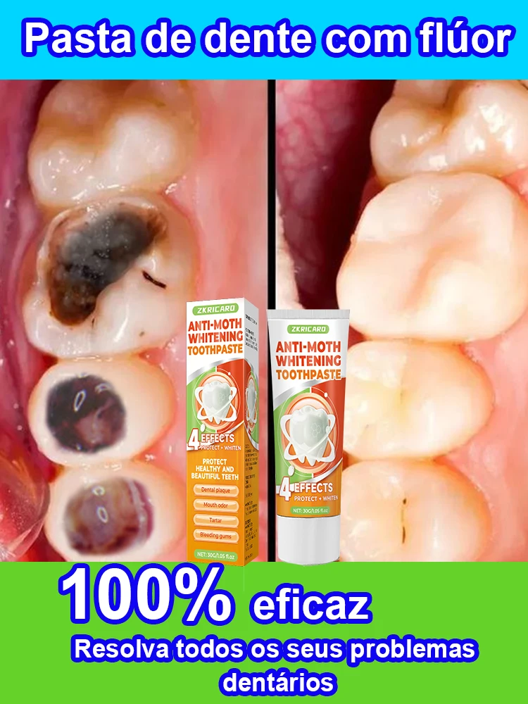 Clarear Reparación De crema Dental, restauración diente