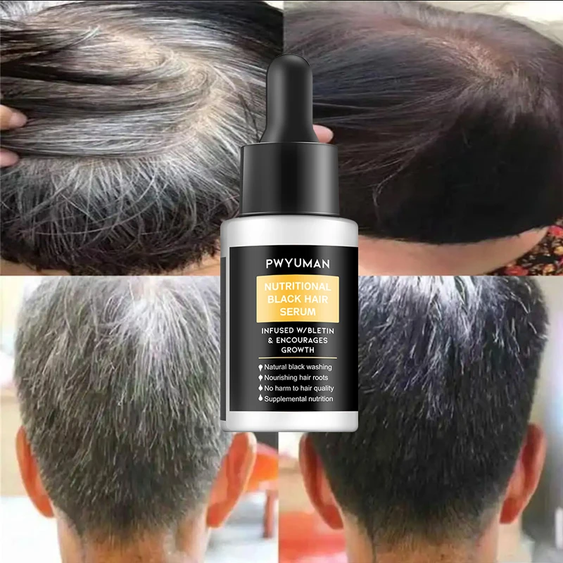 Esencia Anti-gris para el cabello, suero para el ennegrecimiento del cabello, tratamiento para el cabello blanco a negro, cuidado de reparación del