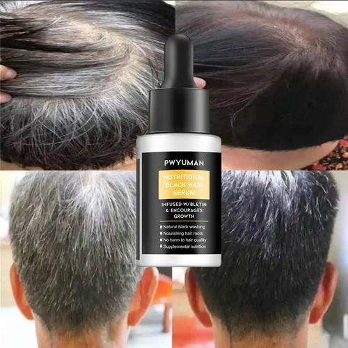 Imagen 2 del producto Esencia para el cabello antigris, suero ennegrecido del cabello, tratamiento del cabello blanco, cuidado de reparación del cabello blanco a negro, nutre el cuero cabelludo, antipérdida de cabello