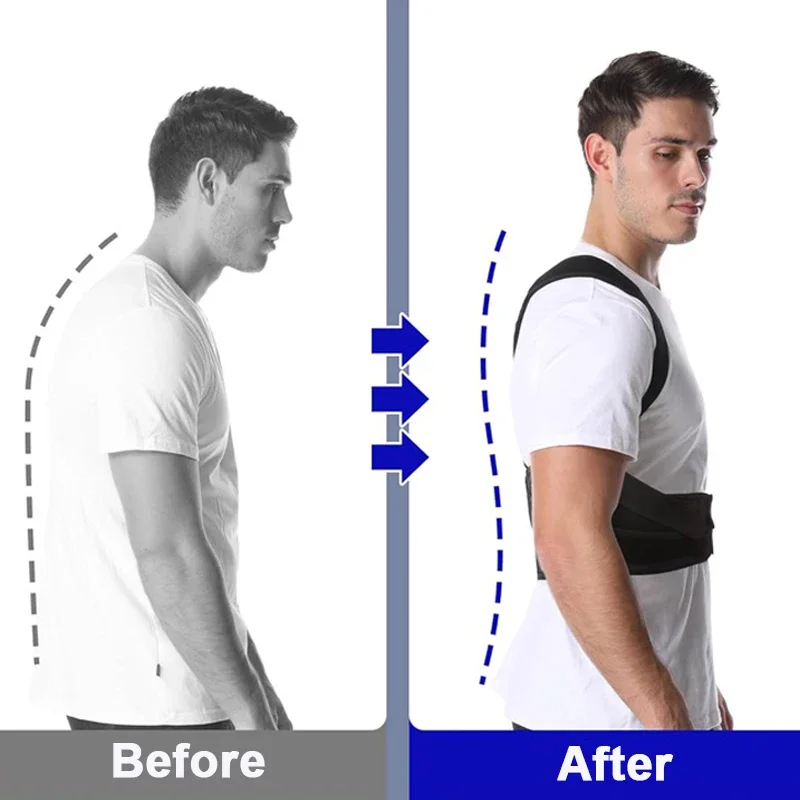 Posture Corrector Back Orthopedic Straps for Men and Women Fully Adjustable Spinal Brace Comfortable Effective Upper Back Brace