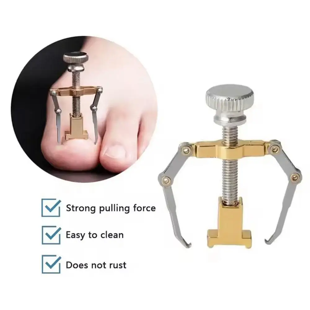 ที่หนีบแก้เล็บขบ เครื่องมือดัดเล็บเท้า ทำเล็บเท้า เครื่องมือเหล็ก ดูแลรักษาเล็บเท้า รักษาเล็บขบ U6L6