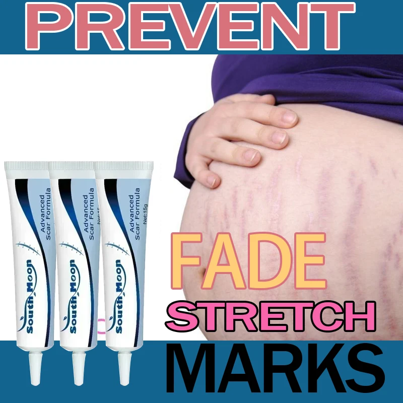 

Maternity Cream That Enhances Elasticity, Gentle Skin Care After Pregnancy, Eliminates Stretch Marks, and Is Very Effective921