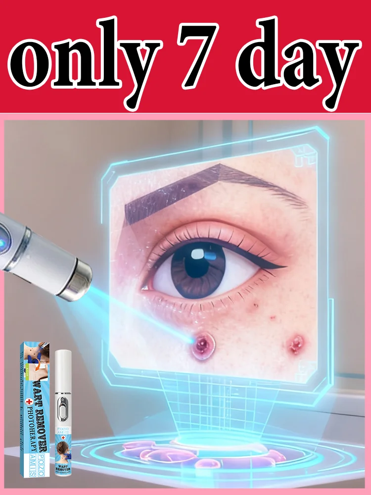 

ʙʟᴜᴇ ʟɪɢʜᴛ ᴘᴇɴ sᴏʟᴠᴇ ᴡᴀʀᴛs, ʜᴏᴛ sᴀʟᴇ ᴡᴀʀᴛ ᴄᴀʀᴇ ᴛᴏᴏʟs