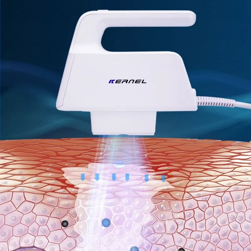 Láser Excimer Portátil Kernel 2025 de Última Generación, 308nm, Experto en Tratamiento Eficaz de Psoriasis y Vitíligo CN-308E