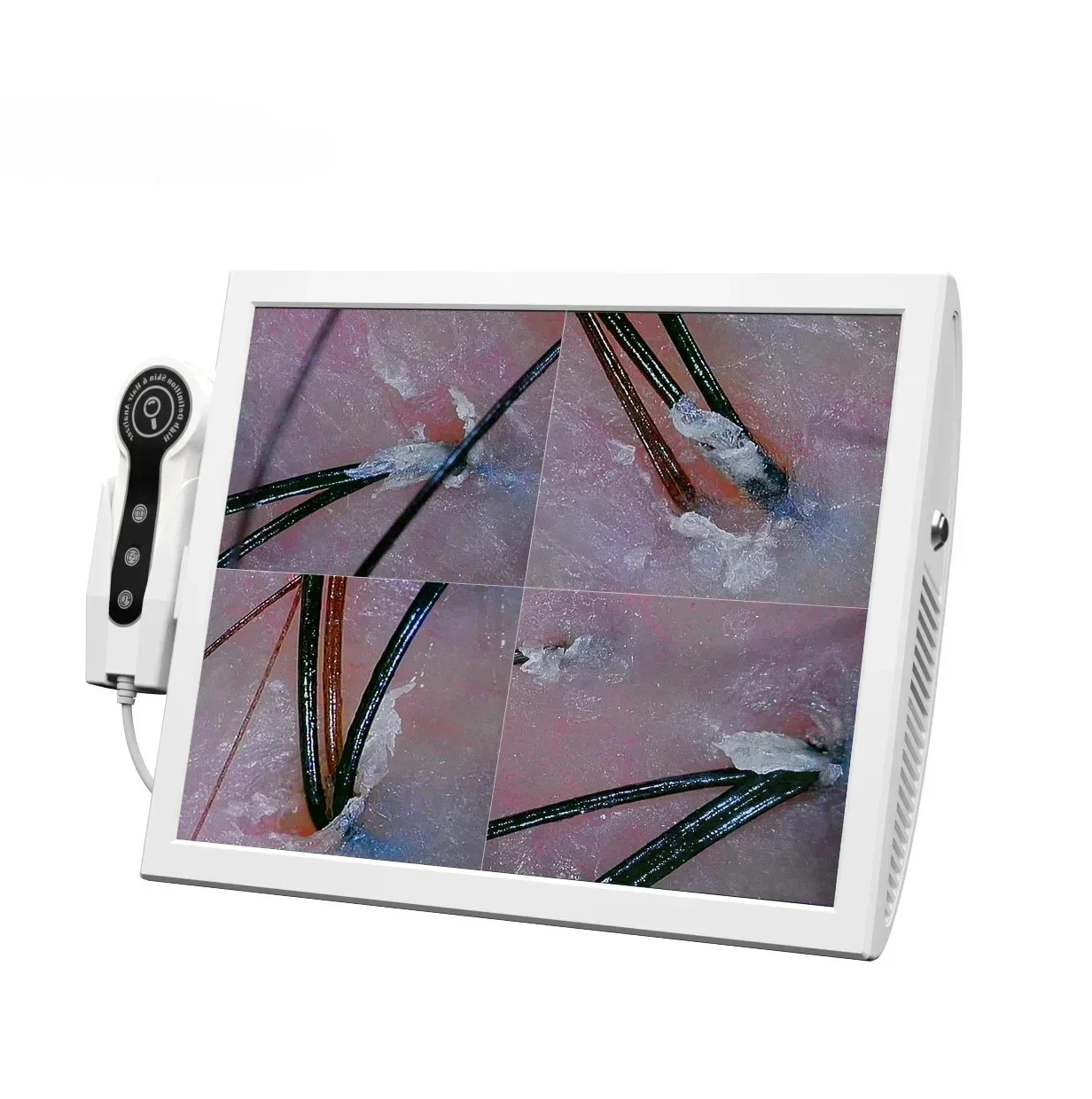 for Professional Scalp Care Hair Follicle Dete=ctor Scalp Analysis Machine / Skin And Hair Analyzer