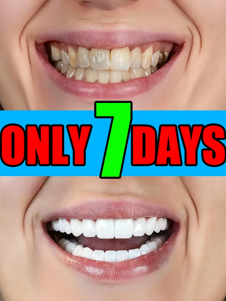 

Probiotic Whitening Toothpaste - Remove Stains, Plaque - Clean Teeth