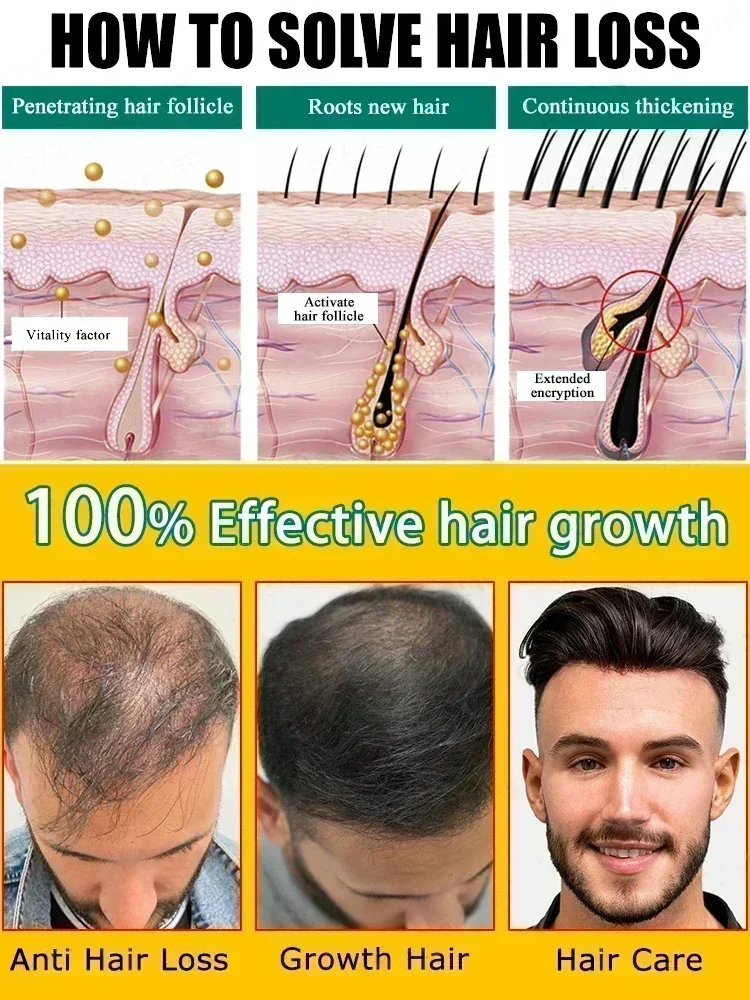 Prevent shedding, reduce hair loss, hair growth,