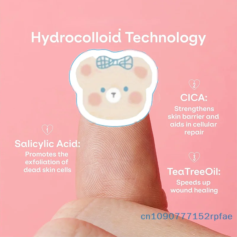 100 قطعة من رقعة بثرة حب الشباب للعناية ببشرة الوجه غير مرئية أدوات احترافية للشفاء والعناية ببشرة الوجه #5