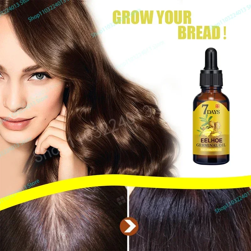 

Sdotter New Oil Hair Growth Products for Man Women Ginger Anti Hair Loss Fast Regrowth