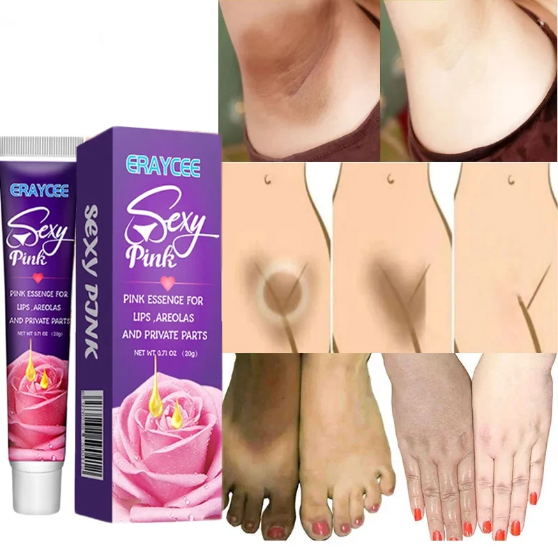 Brightening Cream For Intimate Parts Body Knees Remove Dull Pigments Brighten Serum Elbows Knuckles Lightening Skin Care Product