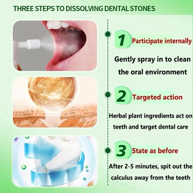 歯石除去剤,歯石のホワイトニングスプレー,歯磨き粉のクリーニング,口腔衛生,口臭の除去,歯垢の汚れ,新鮮な呼吸,2022