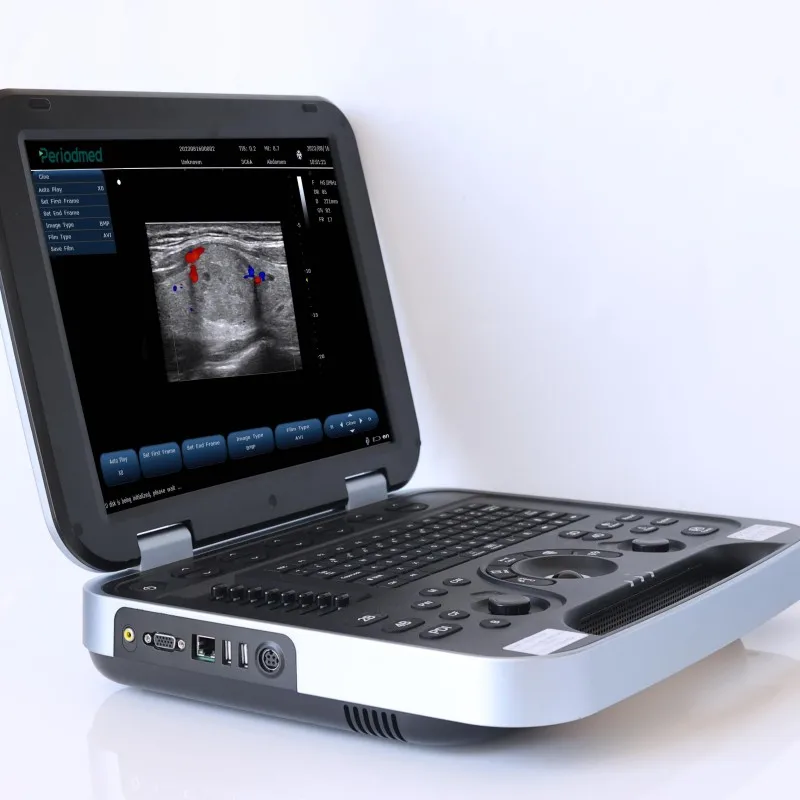 Portable Touchscreen Connectivity Durable Waterproof Multi Mode Image Storage High Resolution Veterinary Ultrasound