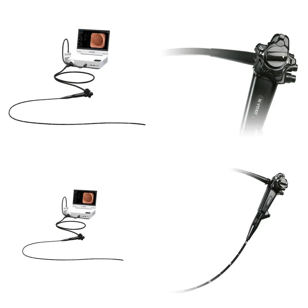 Seller Portable Lightweight High-resolution Veterinary Gastroscope System Series for Equine Diagnose and Treatment