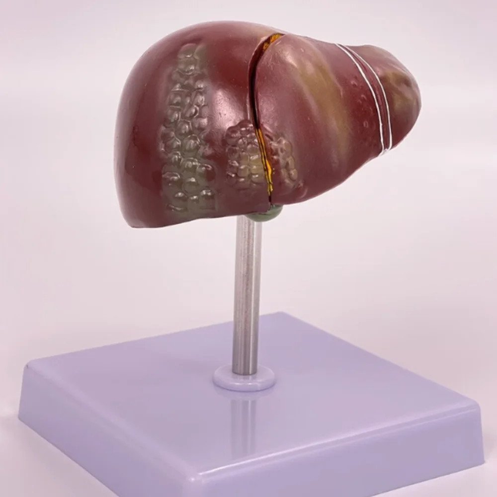 

Высококачественная модель патологии печени, имитирующая модель печени человека