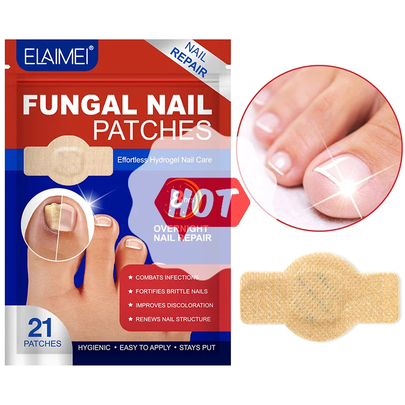 21 Stuks Nagel Schimmel Patch Waterdichte Nagel Reparatie Patch Ingegroeide Correctie Sticker Verkleurde Beschadigde Nagel Grijze Zorg Patches