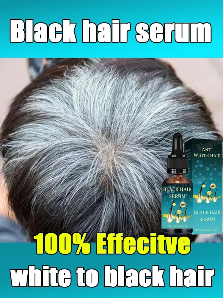 

Natural Anti-Grey Hair Essence Serum No hair color,no allergies Anti-grey hair essence Serum Remedy Healthy