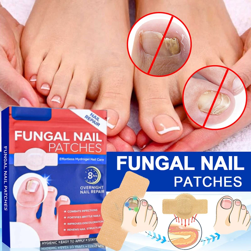 21pcs/bag Nail Fungus Patch Set Nail Repair Ingrown Toenail Correction Stickers for Discolored & Damaged Nails Foot Care Tool