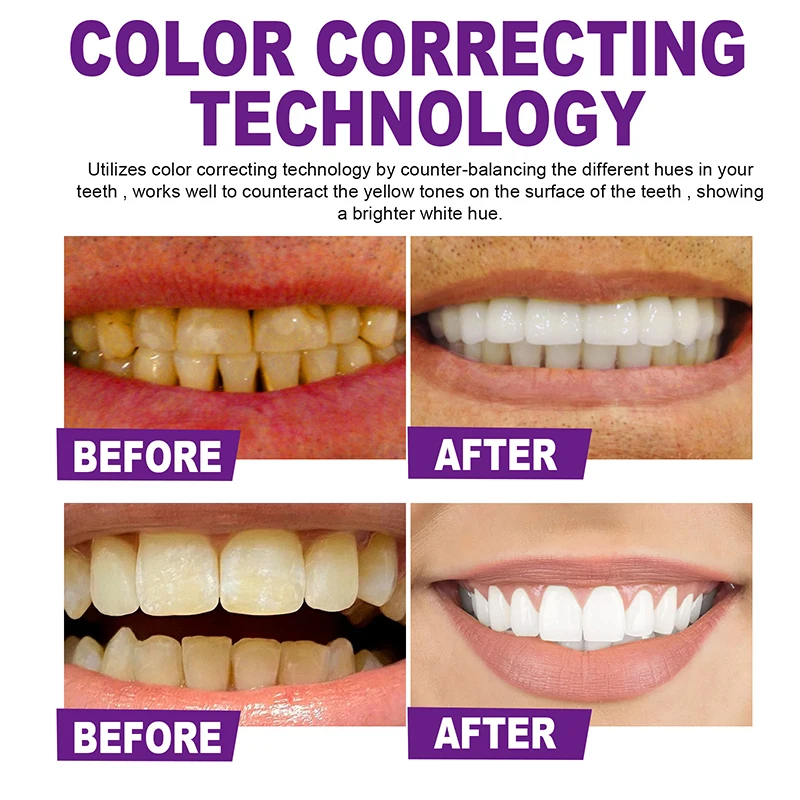 30ml Purple Whitening Toothpaste Removes Stains Reduces Yellowing Care Teeth Gums Fresh Breath Brightens Teeth