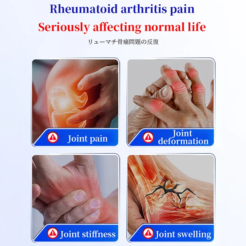 Rheumatic Bone Pain Spray Can Relieve Muscle and Bone Pain, and Can Be Used All over the Body, Including the Cervical Spine, Waist, Knees, Elbows, Shoulders, and Neck Joints