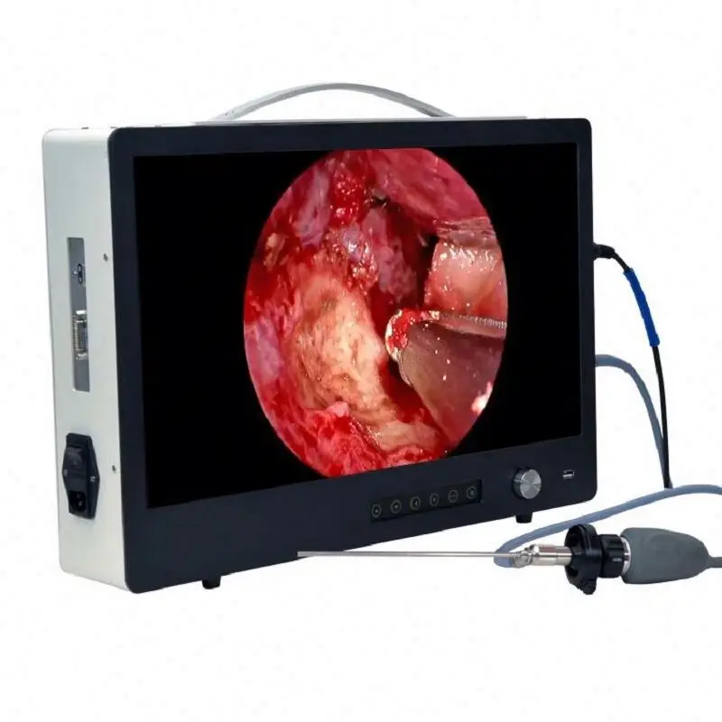 Professional Portable Endoscopic HD Camera Gastroscope Medical 4K Endoscope Camera