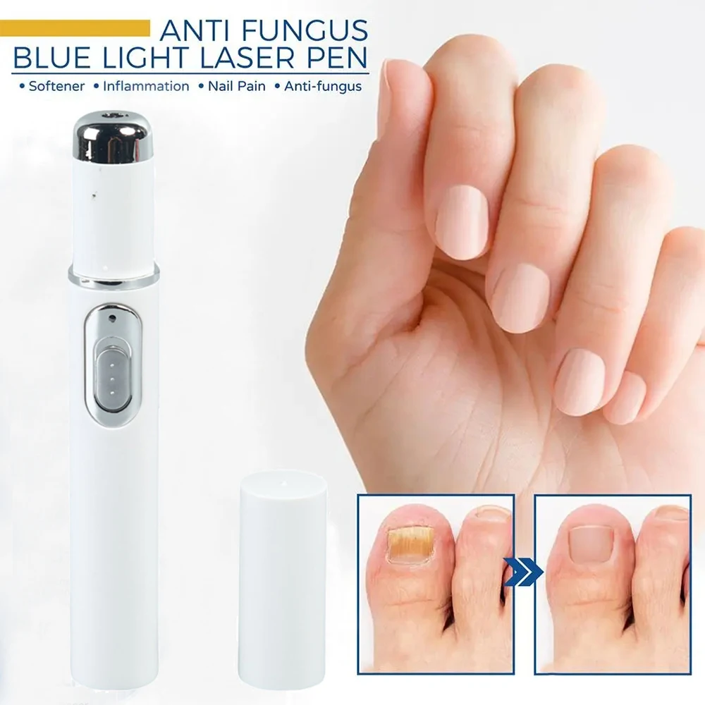 Newly upgraded blue laser pen for skin care, gently caring for every inch of your skin