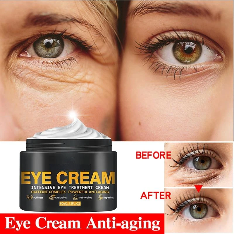 Neueste Anti-Aging straffende Augen creme zum Entfernen von Augenringen Augen taschen Fett Granulat Anti-Falten