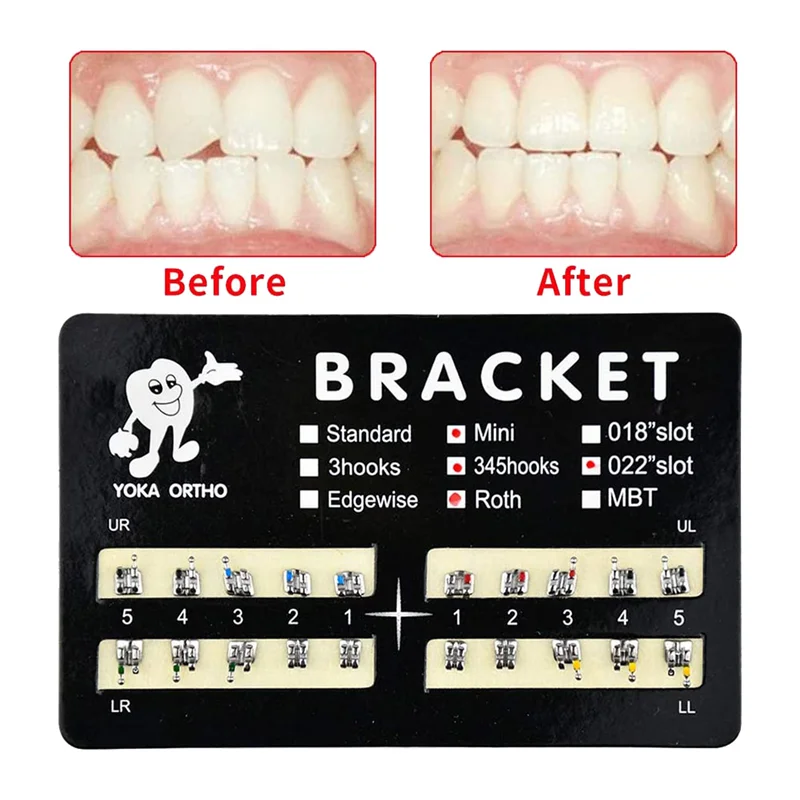 Dentes modelo Mini suportes, 022 slot bondable com gancho, 345, 200pcs