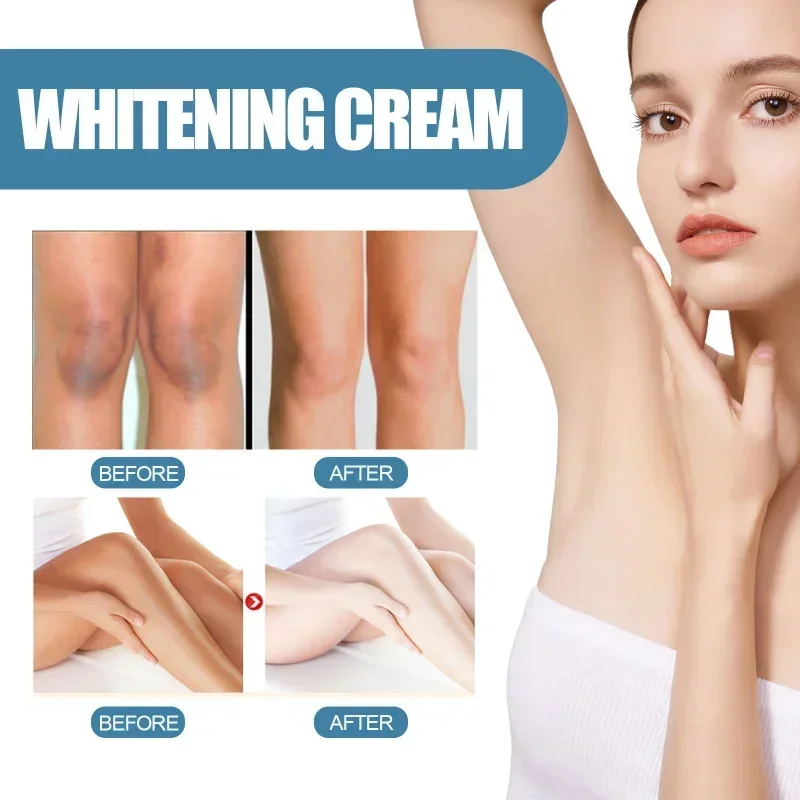 Sdotter New Ｕnder arm whitening cream for women armpit Crotch Underarm bleach groin Whiten Brighten Elbow Knee dark Spots Remove