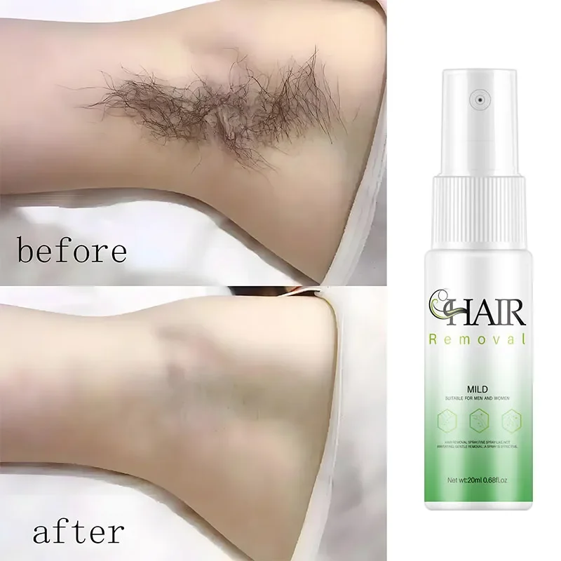 

Hair Removal Spray Powerful Epilator Cream Intimate Areas Health Painless Hair Remover Growth Inhibitor For Woman Men Body Care