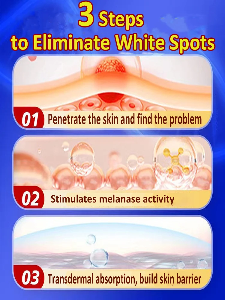 vitiligo magic tool