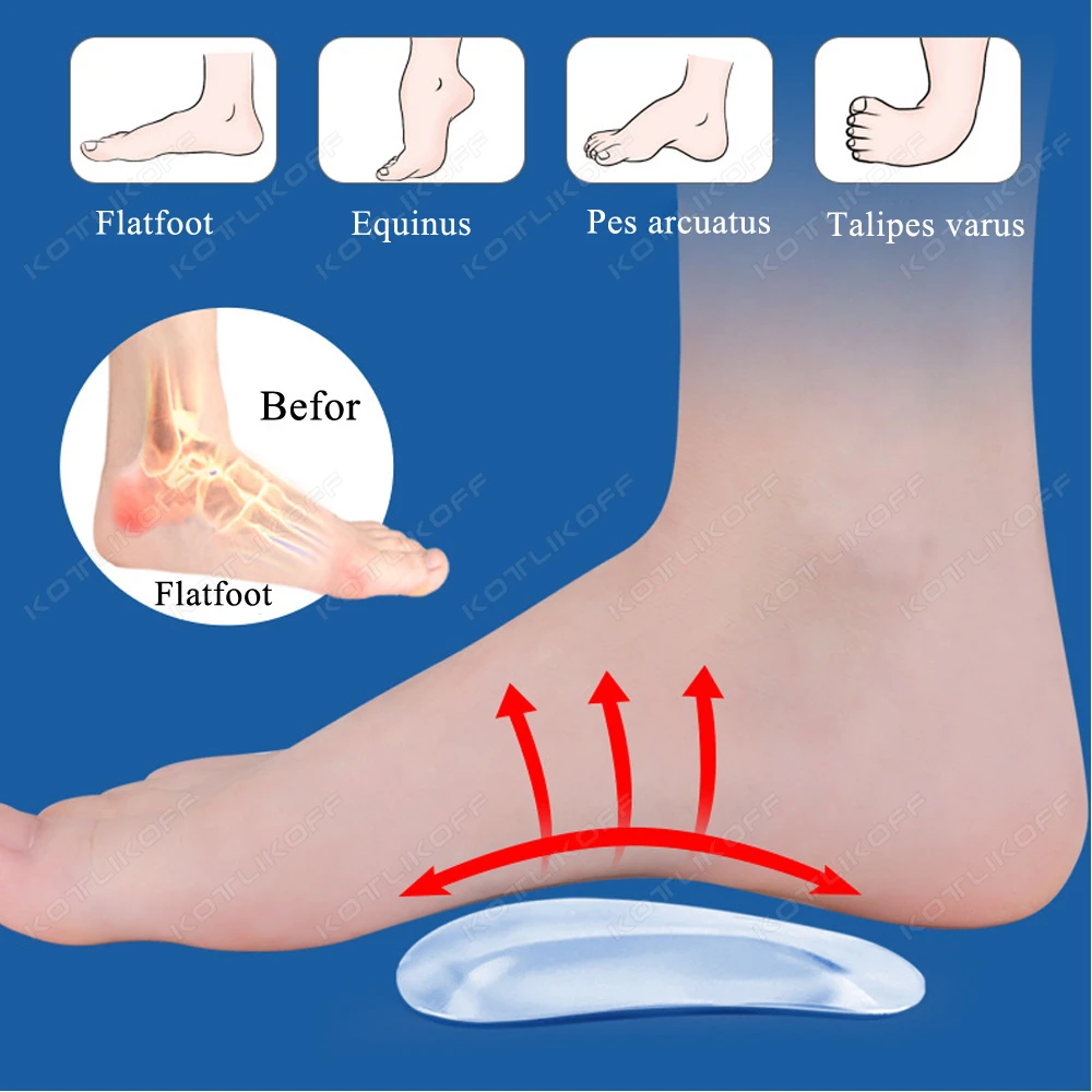 2/4 PCS Gel Thickened Arch Pads Self-Adhesive Adult Flat Foot Support Shock-Absorbing Comfortable Wear-Resistant Non-Slip Pads