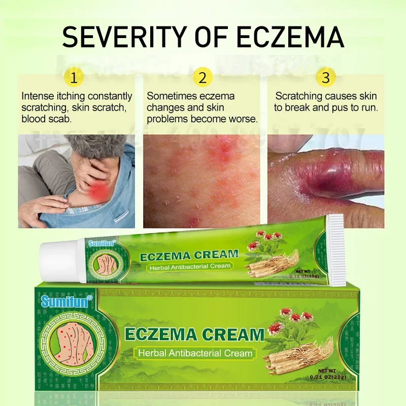 3 Pcs Eczema Cream Skin Care Cream Shidu Qingzhiyang Ointment 20g Herbal Antibacterial Cream Body Health Care