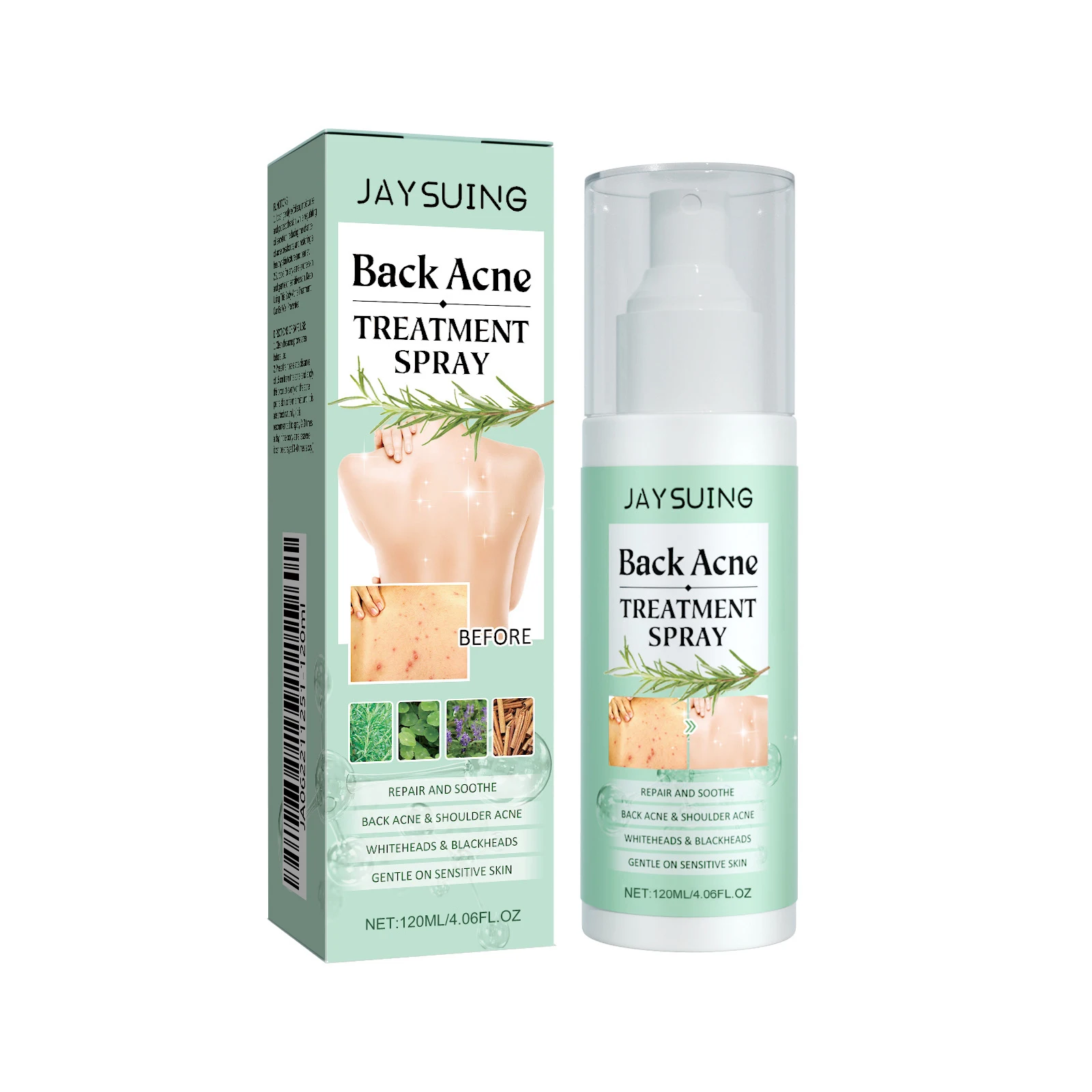 Salicylic Acid Back Acne Spray Centella Repair Acne Mark Reduce Dorsum Pimples Shrink Pores Oil Control Whitening Back Skin Care - view 2