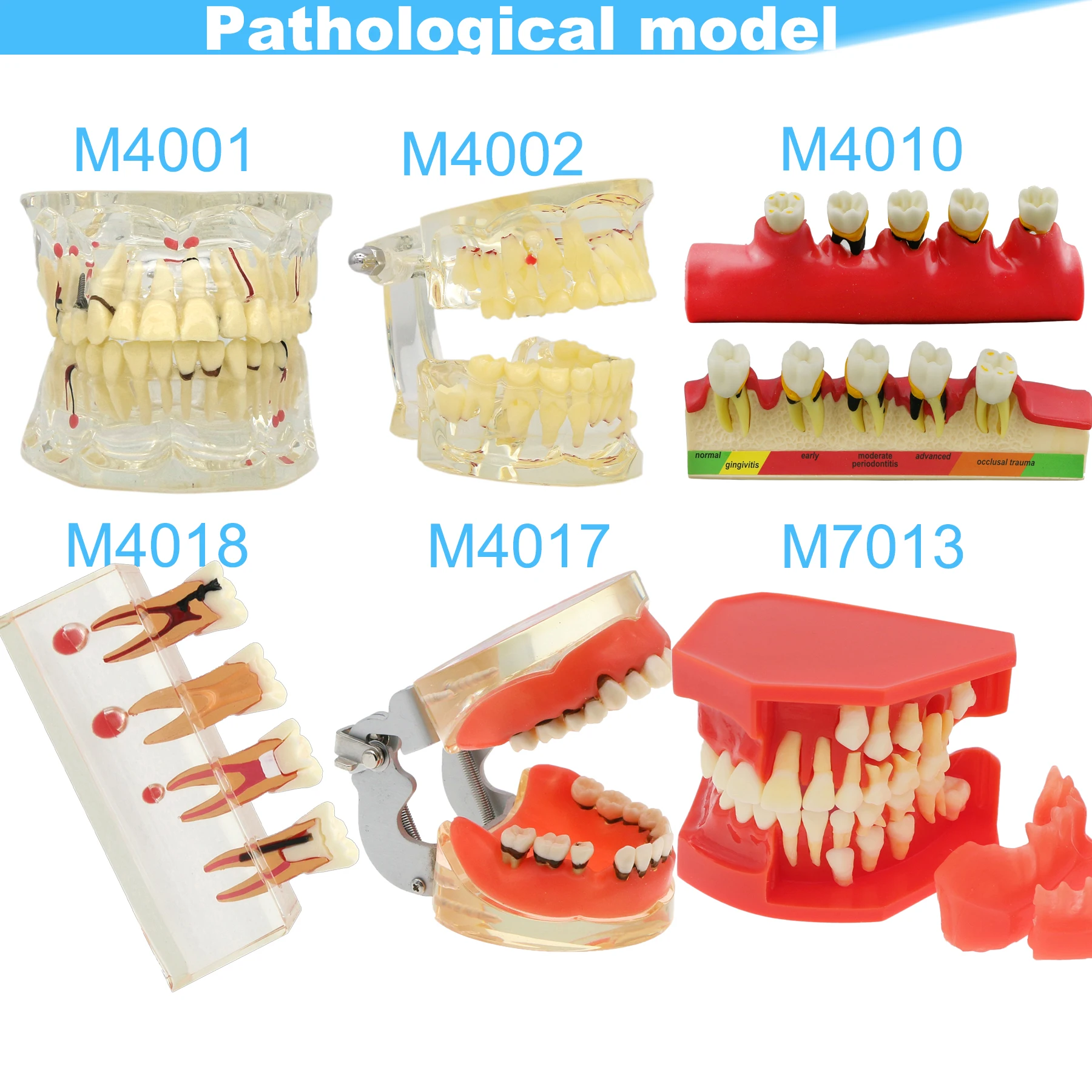 Dental Teeth Model Dental Teaching Model Standard Implants Models Orthodontic Model Dentistry Dentist  Demo Studying